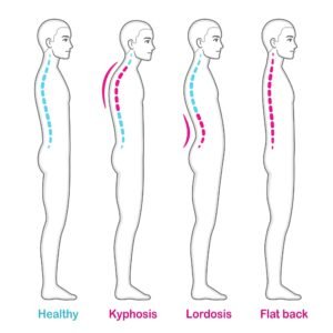 Change in Skeleton