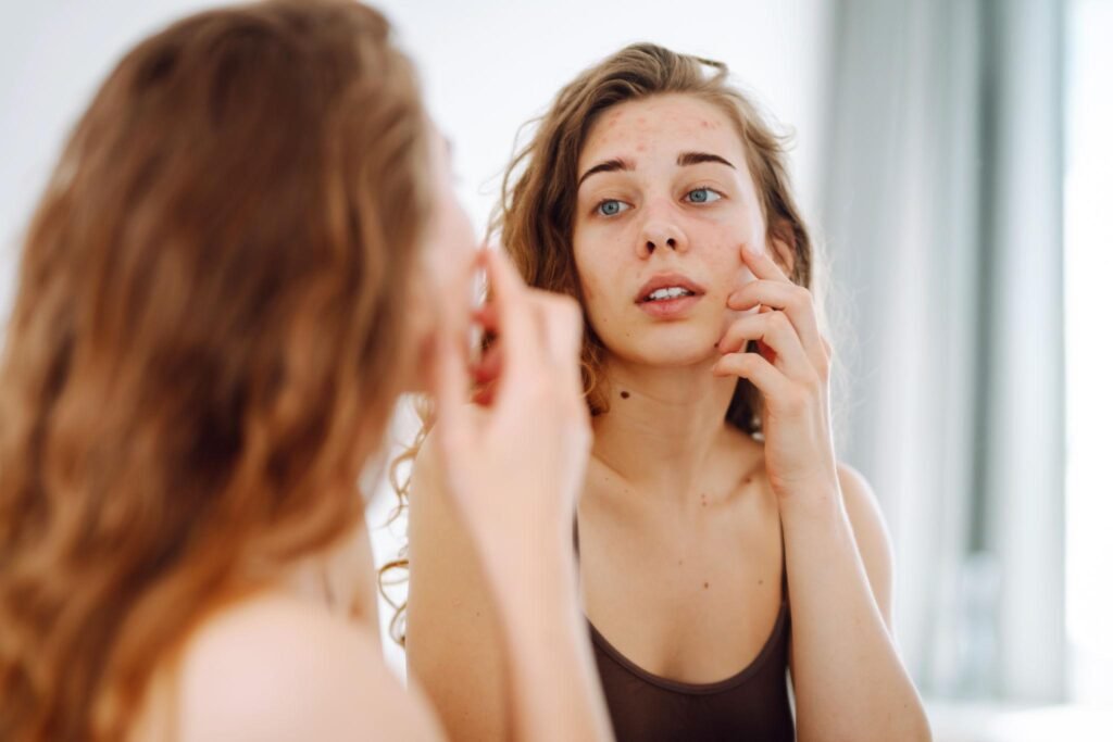 Contraceptives-and-Skin-Health